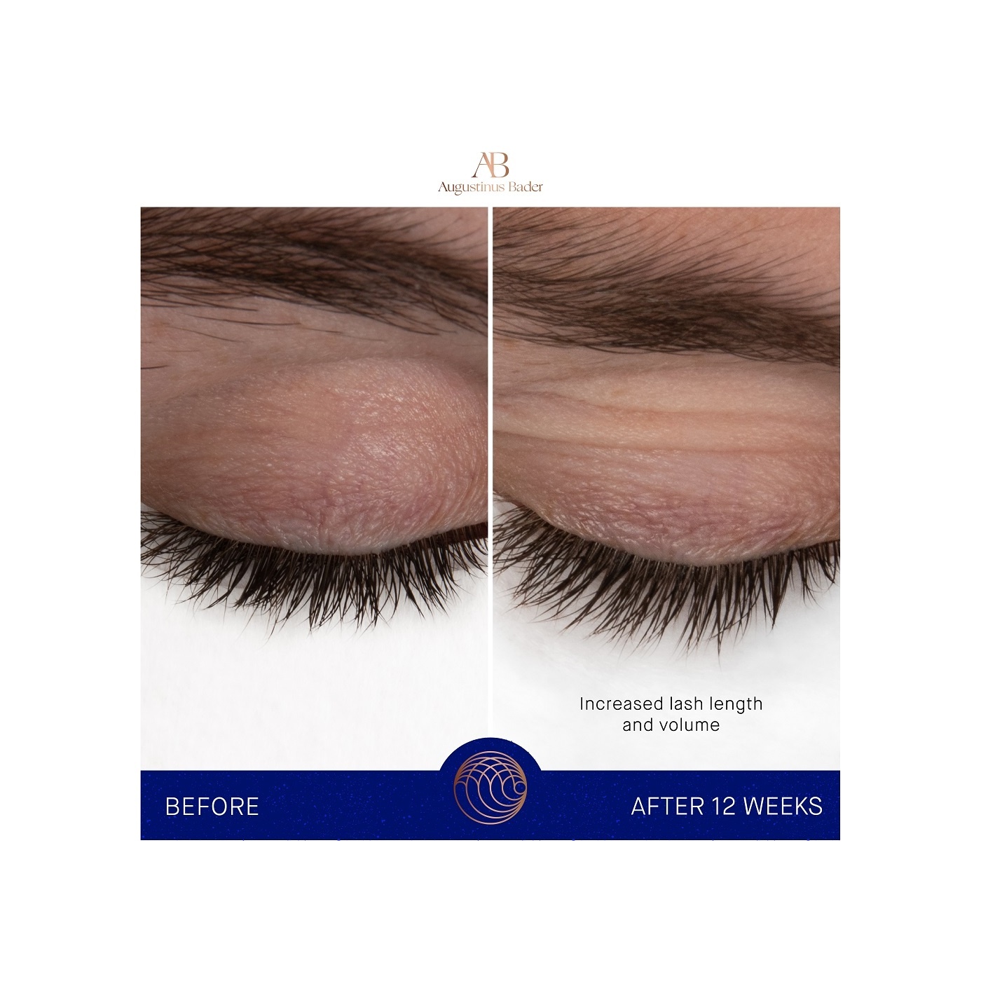 Сыворотка для роста бровей и ресниц Enhancing serum купить в VISAGEHALL