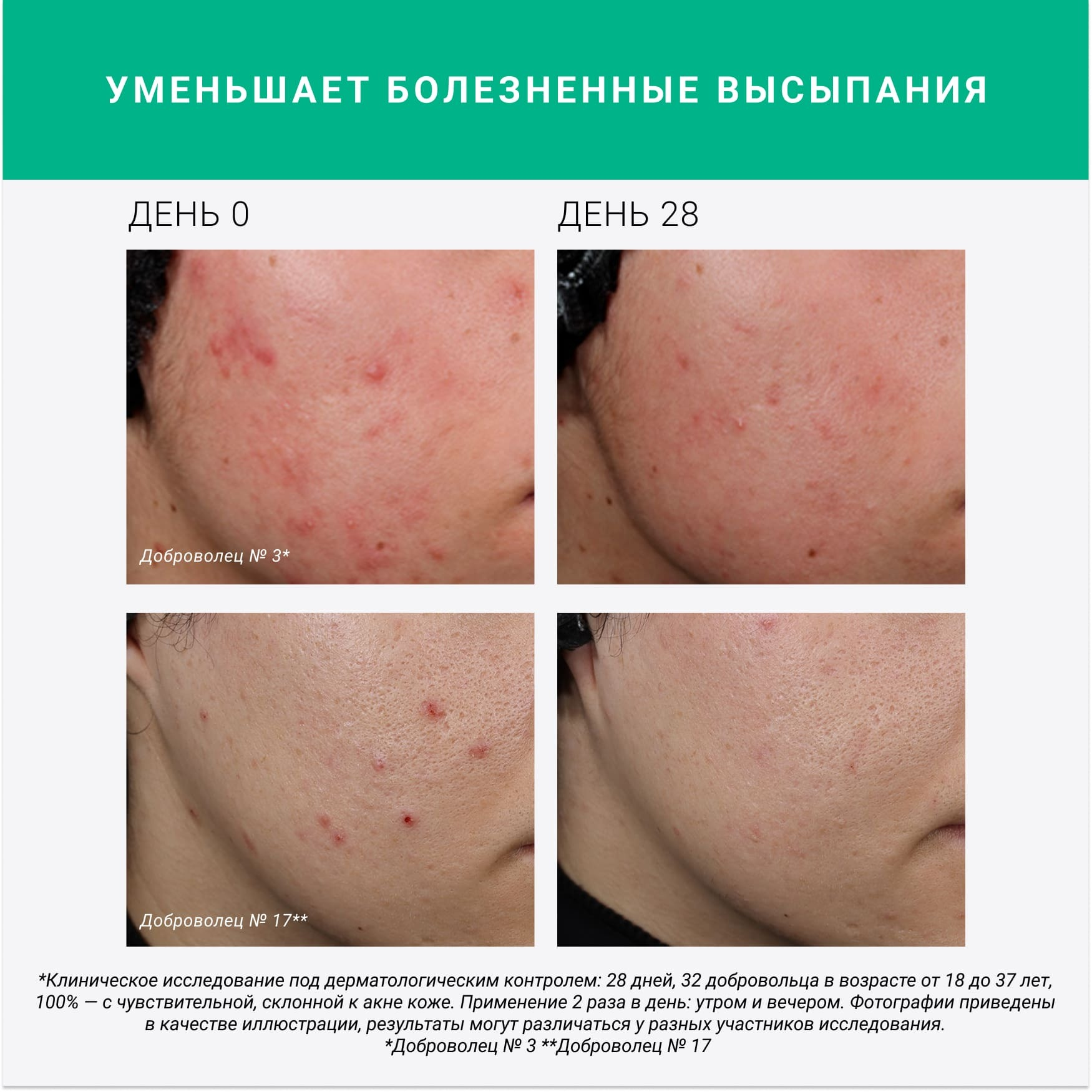 Сыворотка для проблемной кожи с янтарная кислотой 2%