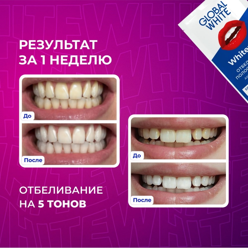 Полоски для зубов отбеливающие Малина купить в VISAGEHALL